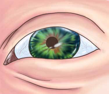 How to Draw a Realistic Eye